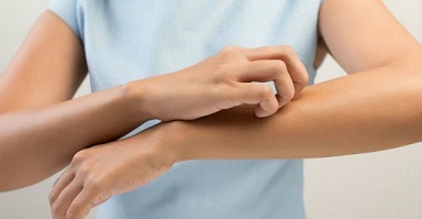 Itchy Skin